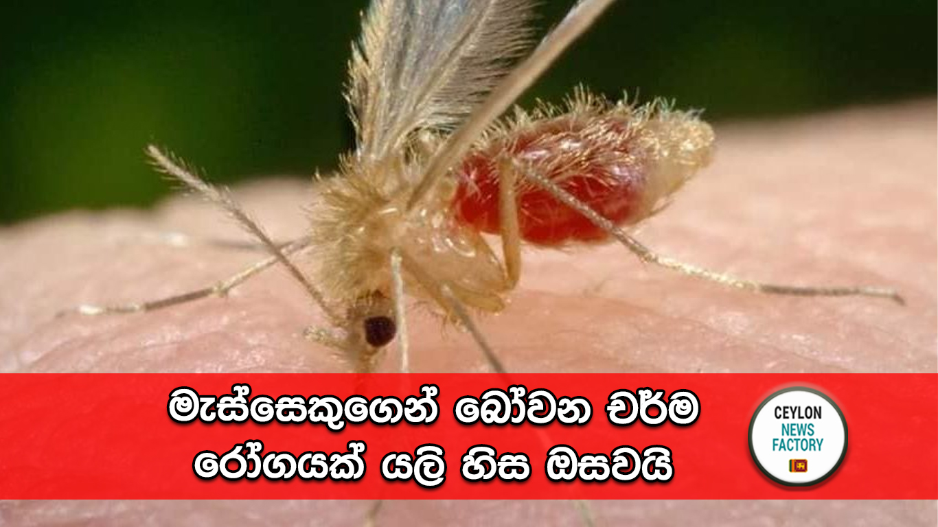 ලීෂ්මේනියාසිස්