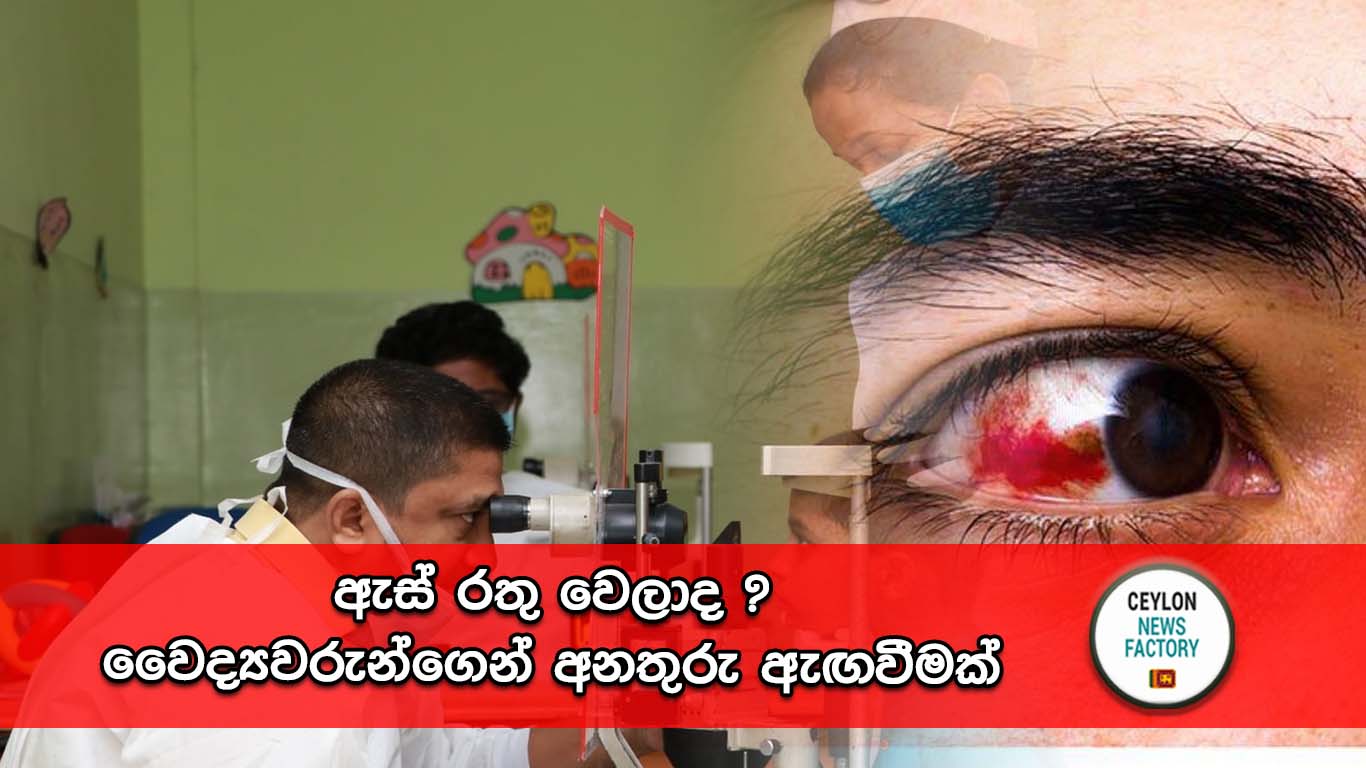 ඇස්